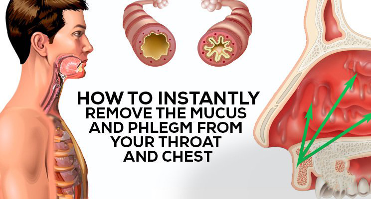 How To Get Rid Of Phlegm And Mucus In Chest Throat Hecspot