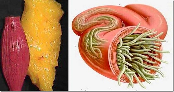 You are currently viewing Just Use These 2 Ingredients To Empty All Deposits of Fat and Parasites Of Your Body Without Effort
